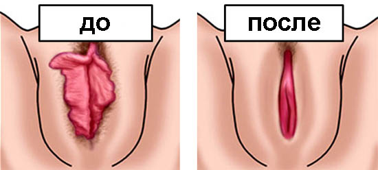 http://sexolog.jofo.ru/data/userfiles/106/images/438023-vagina.jpg